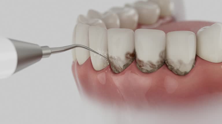 Trusted Dental Implants service in Ashburn, VA - Dentist Open Now
